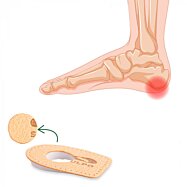 Podpätky na ostrohy koža - latex, telová, Pecari