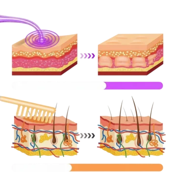 Kozmetický ozonizér – 6-dielna sada na elektroterapiu s hrebienkovou elektródou - Náhľad