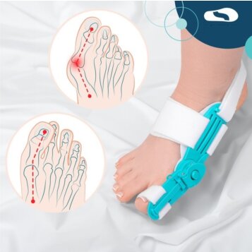 Sada hallux valgus s nastaviteľnou ortézou na deň aj noc, 6 ks