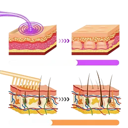 Kozmetický ozonizér – 6-dielna sada na elektroterapiu s hrebienkovou elektródou - Náhľad