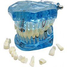 Model chrupu, zubných implantátov