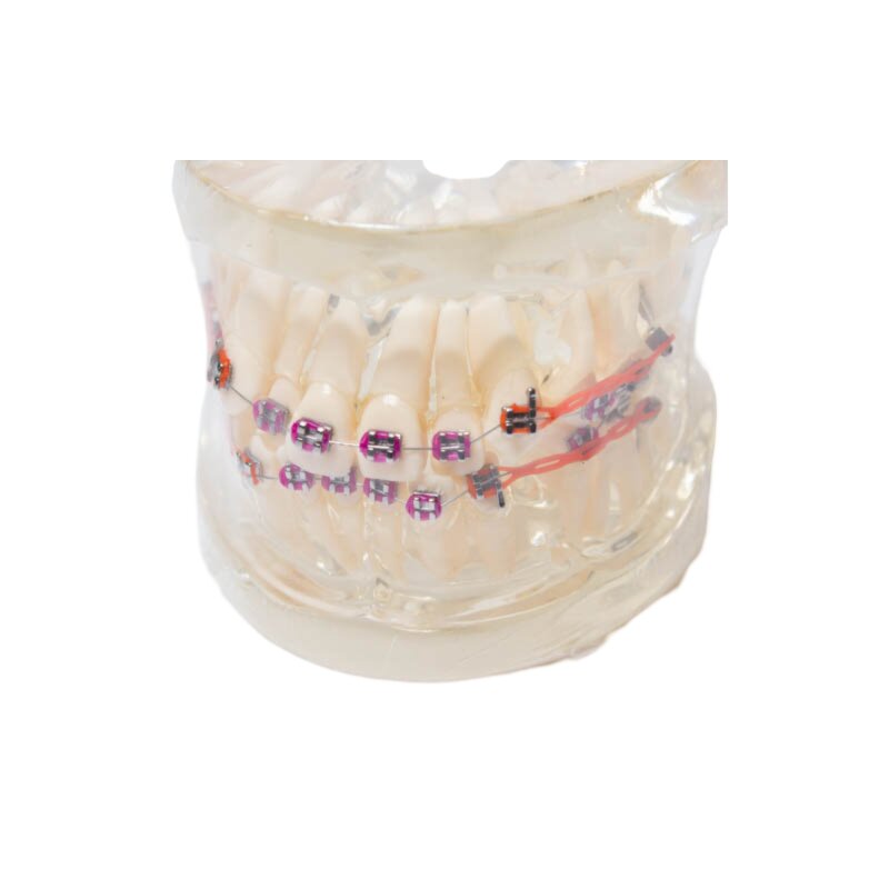 Model zubných implantátov 2